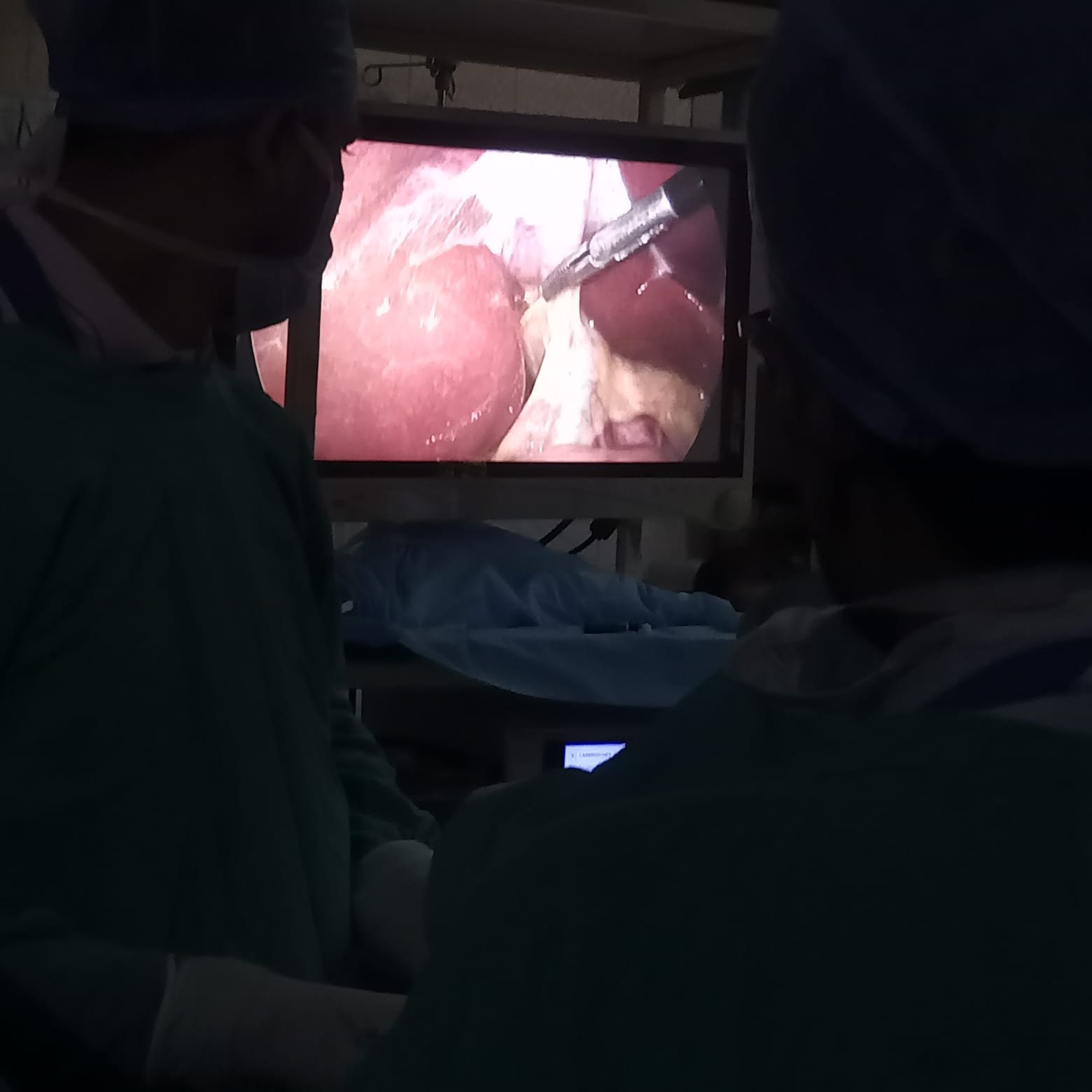 Laparoscopic Surgery